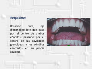 Requisitos:
Rotación pura, eje
diacondíleo (eje que pasa
por el centro de ambos
cóndilos) pasando por el
centro de las cavidades
glenoideas y los cóndilos
centrados en su propia
cavidad.
 