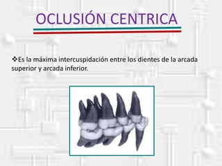 OCLUSIÓN CENTRICA
Es la máxima intercuspidación entre los dientes de la arcada
superior y arcada inferior.
 