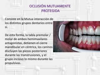 Consiste en la Mutua interacción de
los distintos grupos dentarios entre
si.
De esta forma, la tabla premolar /
molar de ambos hemimaxilares
antagonistas, detienen el cierre
mandibular en céntrica, los caninos
discluyen las piezas posteriores
durante las transtrusiones, y el
grupo incisivo lo mismo durante las
propulsivas.
OCLUSIÓN MUTUAMENTE
PROTEGIDA
 