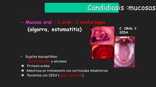 Candidiasis :mucosas
- Mucosa oral : C.oral- C.orofaríngea
(algorra, estomatitis)
• Sujetos susceptibles:
• Recién nacidos y ancianos
 Prótesis orales
 Asmáticos en tratamiento con corticoides inhalatorios
 Pacientes con SIDA (signo centinela)
C. ORAL Y
SIDA
 