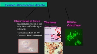 Examen Microscópico directo
Observación al fresco
material clínico con o sin
solución clarificadora y/o
colorante.
Clarificadoras : KOH 10- 40%
Colorantes : Tinta Parker Quink
Tinciones
Gram , Giemsa
Blanco-
Calcofluor
 