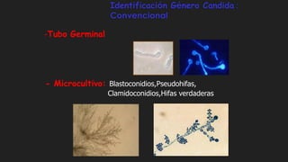 Identificación Género Candida :
Convencional
-Tubo Germinal
- Microcultivo: Blastoconidios,Pseudohifas,
Clamidoconidios,Hifas verdaderas
 