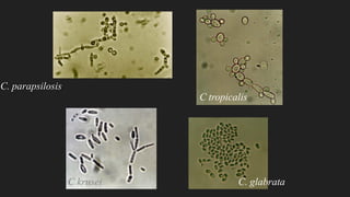 C. parapsilosis
C tropicalis
C krusei C. glabrata
 