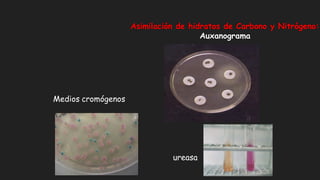 Asimilación de hidratos de Carbono y Nitrógeno:
Auxanograma
Medios cromógenos
ureasa
 