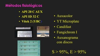 Métodos fisiológicos
• API 20 C AUX
• API ID 32 C
• Vitek 2 (YBC)
• Auxacolor
• YT Microplate
• Candifast
• Fungichrom I
• Auxanograma
con discos
S > 95%, E > 95%
 