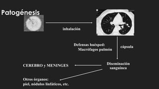 Patogénesis
inhalación
cápsula
Defensas huésped:
Macrófagos pulmón
Diseminación
sanguínea
CEREBRO y MENINGES
Otros órganos:
piel, nódulos linfáticos, etc.
 