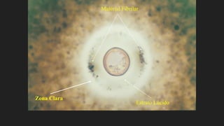 Material Fibrilar
Estrato Lúcido
Zona Clara
 