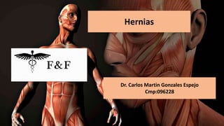 Hernias
Dr. Carlos Martin Gonzales Espejo
Cmp:096228
 