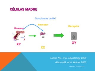 Evidencia en
seres humanos
Hepatocito
Receptor
XY
XX
Donante
XY
Receptor
XX
Theise ND, et al. Hepatology 2000
Alison MR, et al. Nature 2000
Trasplantes de MO
CÉLULAS MADRE
T A M A R A J O R Q U I E R A
 