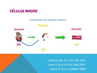 CÉLULAS MADRE
Evidencia en
seres humanos
Trasplantes de órganos sólidos
XY
Donante
Laflamme MA, et al. Circ Res 2002
Quaini F, et al. N Engl J Med 2002
Minami E, et al. Circulation 2005
XX
XY
Donante
Receptor
XY
Cardiomiocito
T A M A R A J O R Q U I E R A
 