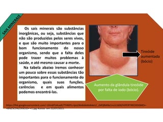 Os sais minerais são substâncias
inorgânicas, ou seja, substâncias que
não são produzidas pelos seres vivos,
e que são muito importantes para o
bom funcionamento do nosso
organismo, sendo que a falta deles
pode trazer muitos problemas à
saúde, e até mesmo causar a morte.
Na tabela abaixo iremos conhecer
um pouco sobre essas substâncias tão
importantes para o funcionamento do
organismo, quais suas funções,
carências e em quais alimentos
podemos encontrá-las.
https://lh6.googleusercontent.com/-UHm87oKuaIE/TY4MYu-lpoI/AAAAAAAAAeU/_zMQ8WBe1ns/s1600/HIPERTIREOIDISMO+-
+B%25C3%2593CIO+-+1.jpg Acesso em 22/07/2015.
Tireóide
aumentada
(bócio)
Aumento da glândula tireóide
por falta de iodo (bócio).
 