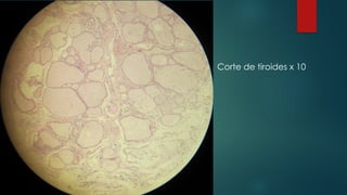 Corte de tiroides x 10
 