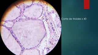 Corte de tiroides x 40
 