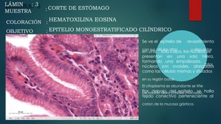 A
LÁMIN : 3
MUESTRA : CORTE DE ESTÓMAGO
Se ve el epitelio de
con sus células altas
revestimiento
y dispuestas
en una sola capa, los núcleos se
presentan en una sola hilera,
Estos
formando una empalizada.
núcleos son ovoides, alargados
como las células mismas y situados
en su región basal.
El citoplasma es abundante se tiñe
de rosado claro (células mucosas).
Por debajo del epitelio se halla
tejido conectivo perteneciente al
corion de la mucosa gástrica.
COLORACIÓN :
OBJETIVO :
HEMATOXILINA EOSINA
EPITELIO MONOESTRATIFICADO CILÍNDRICO
 
