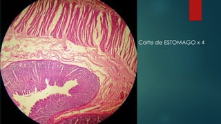 Corte de ESTOMAGO x 4
 