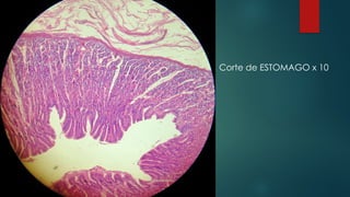 Corte de ESTOMAGO x 10
 