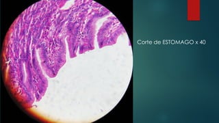 Corte de ESTOMAGO x 40
 