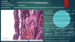 A
LÁMIN : 4
MUESTRA : CORTE DE INTESTINO DELGADO
: HEMATOXILINA
EOSINA
COLORACION :
OBJETIVO : EPITELIO MONOESTRATIFICADO CILINDRICO CON CHAPA ESTRIADA
A menor identificar
que
las
son
vellosidades
evaginaciones o proyecciones digitiformes
de la mucosa.
La mucosa está formada por un epitelio y
una lámina propia.
A mayor aumento observar que el epitelio
está constituido por una sola capa de
células cilíndricas que son de dos tipos: las
absorbentes o enterocitos con citoplasma
rosado, núcleo ovalado ligeramente basal
y que en su borde apical o luminar
acidófila
presenta
birrefringente
una banda
llamada chapa estriada o
borde en cepillo (a la microscopia
electrónica son las micro vellosidades). Las
otras células son las caliciformes o muco
secretores que tienen un citoplasma claro
 
