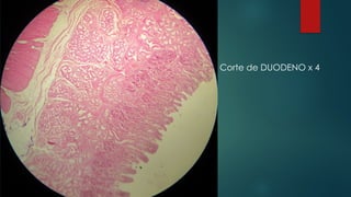 Corte de DUODENO x 4
 