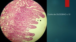 Corte de DUODENO x 10
 