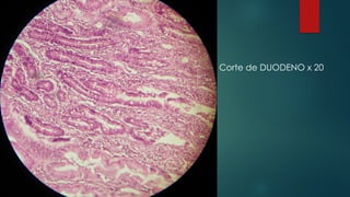 Corte de DUODENO x 20
 