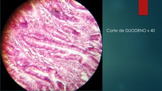 Corte de DUODENO x 40
 