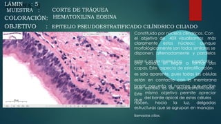 A
LÁMIN : 5
MUESTRA : CORTE DE TRÁQUEA
HEMATOXILINA EOSINA
COLORACIÓN:
OBJETIVO :
Constituido por núcleos cilíndricos. Con
el objetivo de 40X visualizamos más
claramente estos núcleos: aunque
morfológicamente son todos similares se
disponen, alternadamente
entre sí, en dos niveles (uno
y paralelos
superficial y
otro basal), sin llegar a formar dos
capas. Este aspecto de estratificación
es solo aparente, pues todas las células
están en contacto con la membrana
basal; por esto el nombre que recibe
este
Este
que
epitelio es de seudoestratificado.
mismo objetivo permite apreciar
del borde apical de estas células
nacen, hacia la luz, delgadas
estructuras que se agrupan en manojos
llamadas cilios.
EPITELIO PSEUDOESTRATIFICADO CILÍNDRICO CILIADO
 