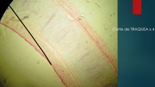 Corte de TRAQUEA x 4
 