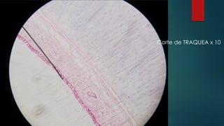 Corte de TRAQUEA x 10
 