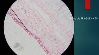 Corte de TRAQUEA x 20
 