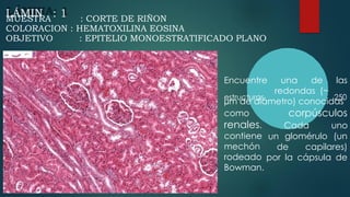 A
LÁMIN : 1
MUESTRA : CORTE DE RIÑON
COLORACION : HEMATOXILINA EOSINA
OBJETIVO : EPITELIO MONOESTRATIFICADO PLANO
Encuentre
estructuras
una de las
250
redondas (~
µm de diámetro) conocidas
corpúsculos
como
renales.
contiene
mechón
rodeado
Bowman.
Cada
glomérulo
uno
(un
un
de capilares)
por la cápsula de
 