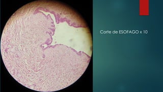 Corte de ESOFAGO x 10
 
