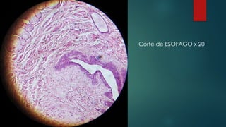 Corte de ESOFAGO x 20
 