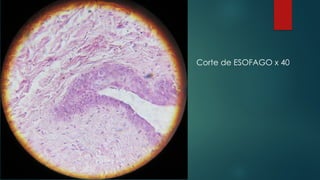 Corte de ESOFAGO x 40
 