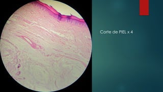 Corte de PIEL x 4
 