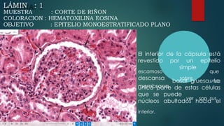 A
LÁMIN : 1
MUESTRA : CORTE DE RIÑON
COLORACION : HEMATOXILINA EOSINA
OBJETIVO : EPITELIO MONOESTRATIFICADO PLANO
El interior de la cápsula está
revestido
escamoso
descansa
membrana
por un epitelio
que
una
simple
sobre
basal gruesa. La
única parte de estas
ver
células
son sus
que se puede
núcleos
interior.
abultados hacia el
 