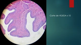 Corte de VEJIGA x 10
 