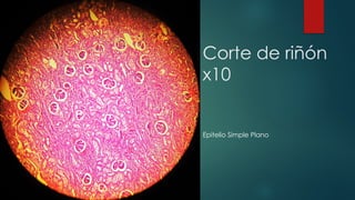 Corte de riñón
x10
Epitelio Simple Plano
 