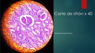 Corte de riñón x 40
 