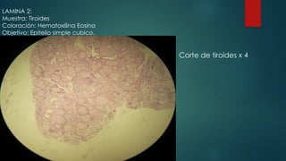 1 1 1 1 1 1 1
LAMINA 2:
Muestra: Tiroides
Coloración: Hematoxilina Eosina
Objetivo: Epitelio simple cubico.
Corte de tiroides x 4
 