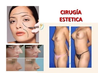 CIRUGÍA
ESTETICA

 