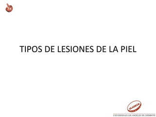 TIPOS DE LESIONES DE LA PIEL
 
