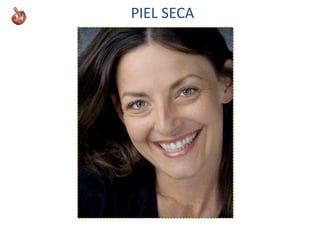 PIEL SECA
 