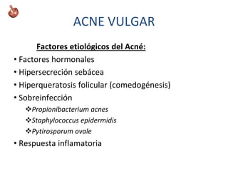Factores etiológicos del Acné:
• Factores hormonales
• Hipersecreción sebácea
• Hiperqueratosis folicular (comedogénesis)
• Sobreinfección
Propionibacterium acnes
Staphylococcus epidermidis
Pytirosporum ovale
• Respuesta inflamatoria
ACNE VULGAR
 