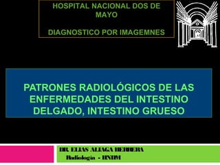 PATRONES RADIOLÓGICOS DE LAS
ENFERMEDADES DEL INTESTINO
DELGADO, INTESTINO GRUESO
DR. ELIAS ALIAGA HERRERA
Radiología - HNDM
HOSPITAL NACIONAL DOS DE
MAYO
DIAGNOSTICO POR IMAGEMNES
 