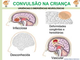 Ivanilson Ribeiro-Enfermeiro
CONVULSÃO NA CRIANÇA
Infecciosa
Desconhecida
Deformidades
congênitas e
hereditárias
Vascular
URGÊNCIAS E EMERGÊNCIAS NEUROLÓGICAS
 