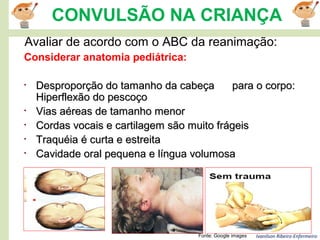 Ivanilson Ribeiro-Enfermeiro
CONVULSÃO NA CRIANÇA
Avaliar de acordo com o ABC da reanimação:
Fonte: Google images
Considerar anatomia pediátrica:
• Desproporção do tamanho da cabeça para o corpo:Desproporção do tamanho da cabeça para o corpo:
Hiperflexão do pescoçoHiperflexão do pescoço
• Vias aéreas de tamanho menorVias aéreas de tamanho menor
• Cordas vocais e cartilagem são muito frágeisCordas vocais e cartilagem são muito frágeis
• Traquéia é curta e estreitaTraquéia é curta e estreita
• Cavidade oral pequena e língua volumosaCavidade oral pequena e língua volumosa
 