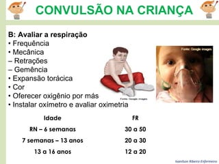 Ivanilson Ribeiro-Enfermeiro
CONVULSÃO NA CRIANÇA
B: Avaliar a respiração
• Frequência
• Mecânica
– Retrações
– Gemência
• Expansão torácica
• Cor
• Oferecer oxigênio por máscara
• Instalar oxímetro e avaliar oximetria
Idade FR
RN – 6 semanas 30 a 50
7 semanas – 13 anos 20 a 30
13 a 16 anos 12 a 20
 