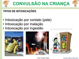 Ivanilson Ribeiro-Enfermeiro
CONVULSÃO NA CRIANÇA
TIPOS DE INTOXICAÇÕES
• Intoxicação por contato (pele)
• Intoxicação por inalação
• Intoxicação por ingestão
Fonte: Google images
 