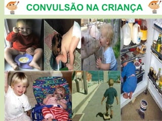 Ivanilson Ribeiro-Enfermeiro
CONVULSÃO NA CRIANÇA
 